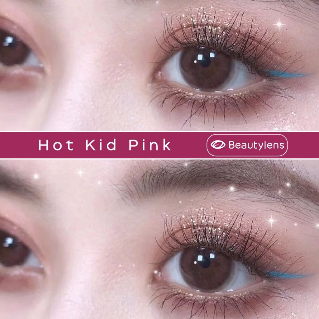 Live18 Hot Kid Pink 14.0mm Beauty Lens - Pink & Brown Colored Contact Lenses (Normal & Minus Power Available)