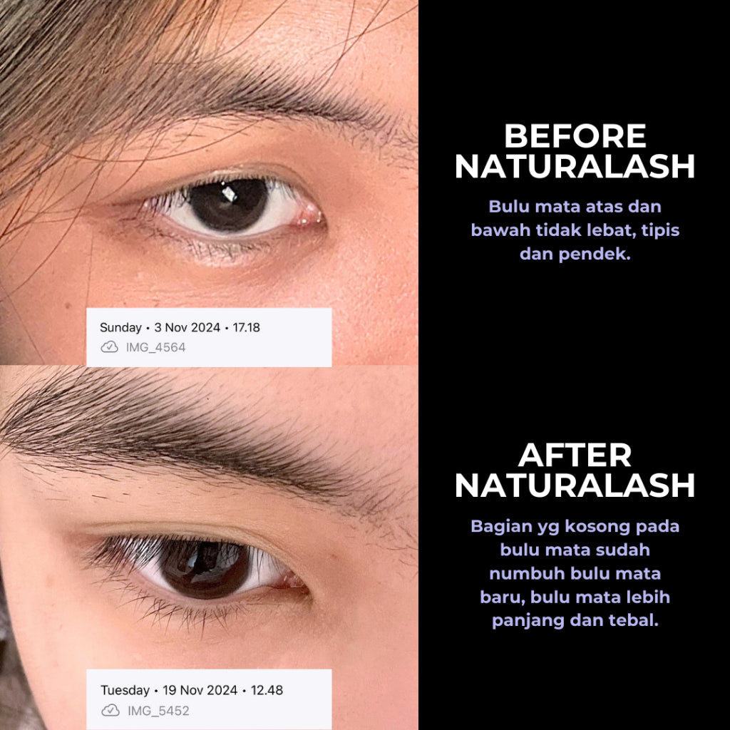 Naturalash Concentrated Lash & Brow Serum (No.1 Serum Penumbuh Bulu Mata dan Alis) with Rosemary Oil by Naturalens | Eyelash Lash Bulumata Eyebrow